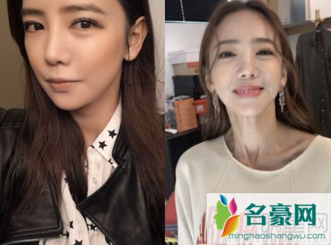 韩星李泰林减肥暴瘦 过于骨感十分吓人