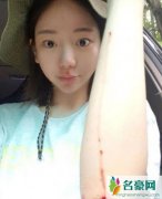 黄荷娜出狱后近照 晒出受伤流血照遭网友争议