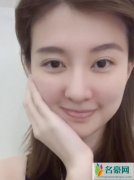 乔欣拔完智齿后 脸颊肿胀网友怀疑是不是开了特效