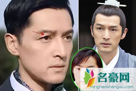 胡歌车祸前后对比图 胡歌车祸原因大揭秘