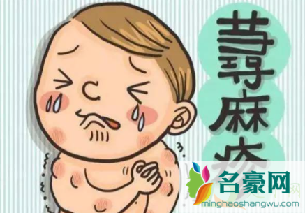 荨麻疹吃螃蟹会加重病情吗1