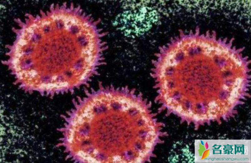 肺炎和感冒的症状区别 新型冠状病毒肺炎怎么预防