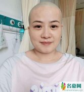 岳云鹏老婆剃光头 晒近照对镜微笑状态不错