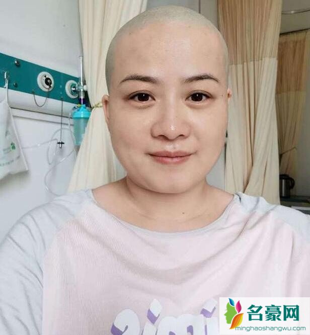 岳云鹏老婆剃光头