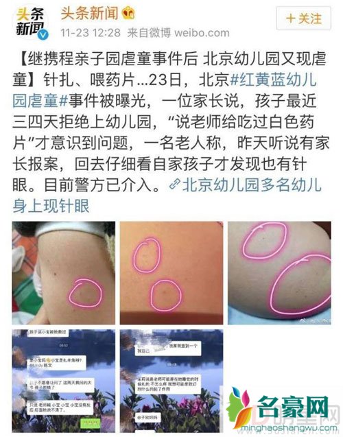 红黄蓝幼儿园涉虐童 章子怡伊能静带头发声