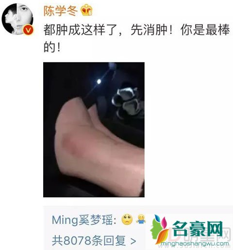 陈学冬晒奚梦瑶脚肿照片被揭穿 这种作假力挺并不好