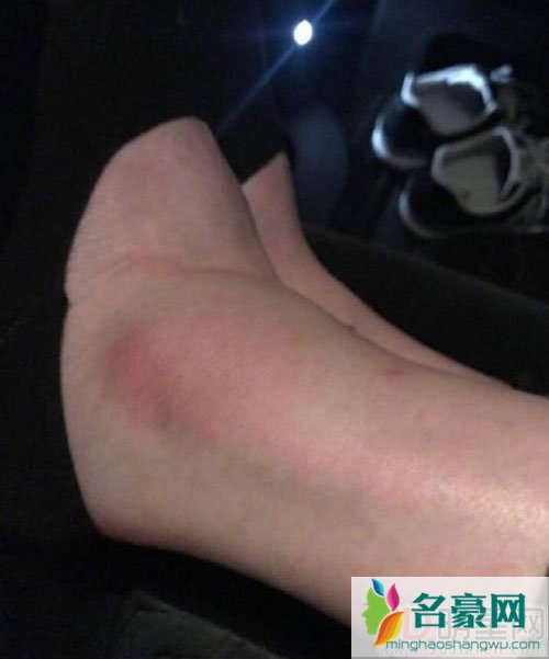 奚梦瑶成维密摔跤第一人 微博回应对不起