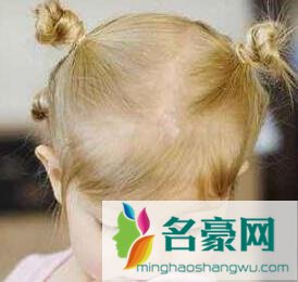 小女孩双丸子头扎法图解_儿童扎丸子头简单好看造型2
