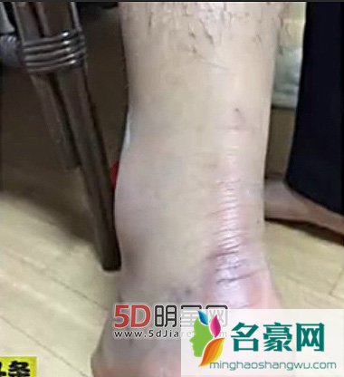 黄子韬解约SM发微博“对不起，感恩” 黄子韬昔日受伤图