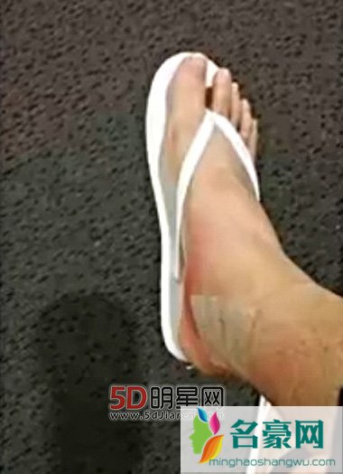黄子韬解约SM发微博“对不起，感恩” 黄子韬昔日受伤图