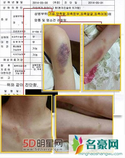 金贤重否认打女友对女友家暴 金贤重打的女友是谁