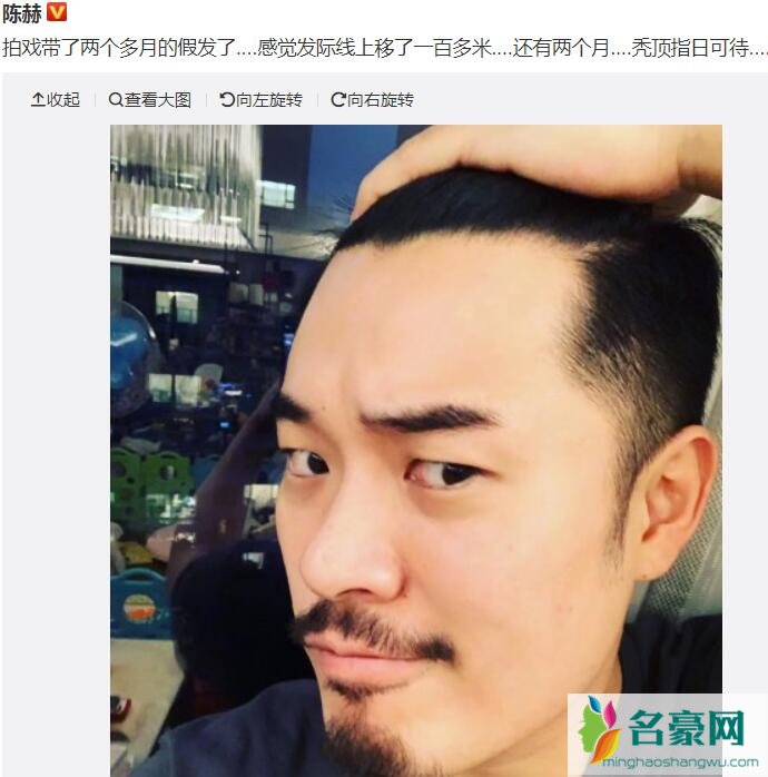 陈赫秃顶指日可待