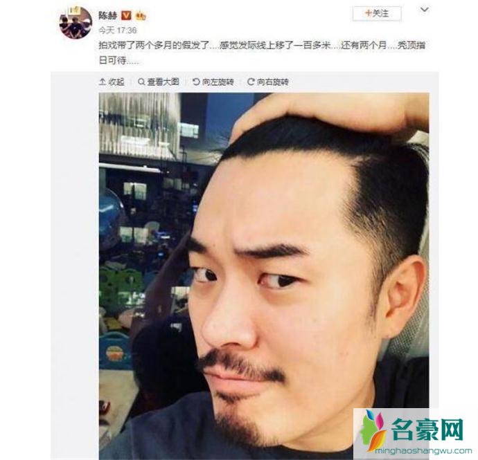 陈赫发文表示自己要秃顶了