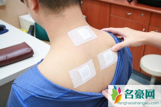 贴三伏贴可以打点滴吗2