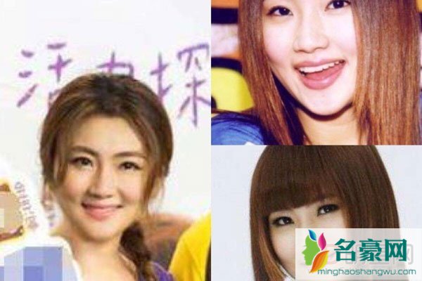 selina烧伤前后对比真实照片 你们娶个老婆浑身烧伤不能搞事不离婚吗