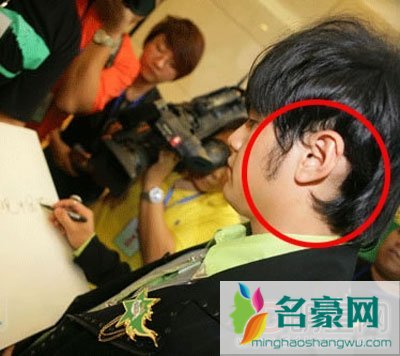 周杰伦植发了吗 周董这辈子真是辉煌啊有钱就是好