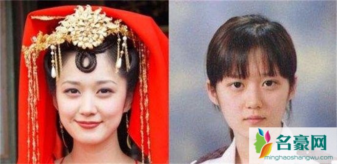 张娜拉整容前后对比