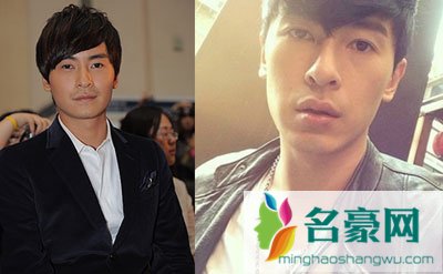 郑元畅是不是整容了 郑元畅为什么整容