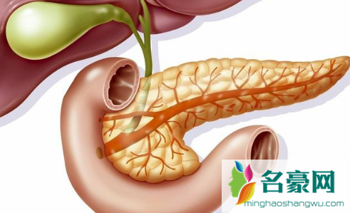 重症急性胰腺炎有救吗2
