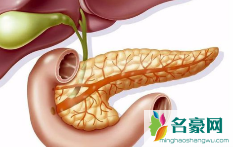 诊断胰腺炎但一直不疼严重吗3