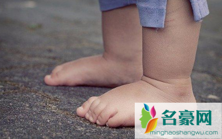 老寒腿与风湿的区别在哪里3