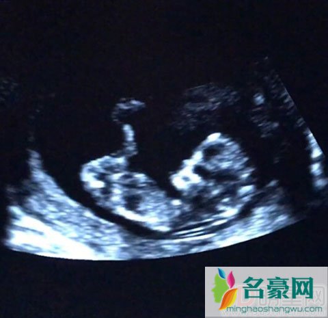 胡杏儿晒孕照报喜 婆婆疼自己比老公多