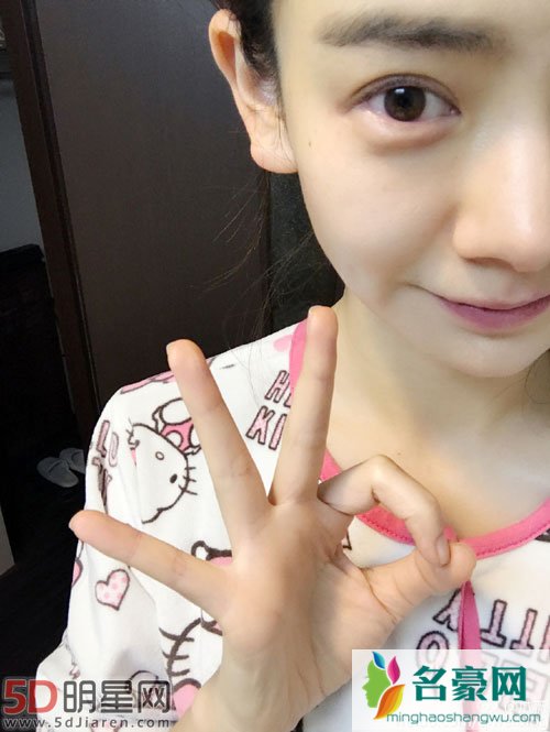 戚薇日本受伤 微博晒半张脸报平安