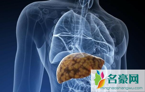 补硒治愈了我的肝病真的吗2