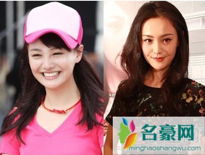郑爽跟张翰什么关系 郑爽整容前后张翰