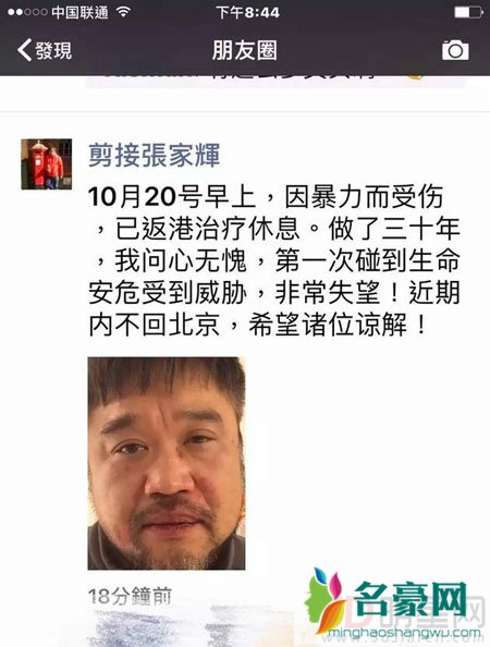 张嘉辉自曝被打 海纳盛世回应：是互殴