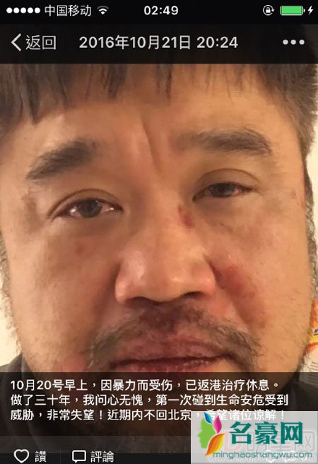 张嘉辉自曝被打 海纳盛世回应：是互殴