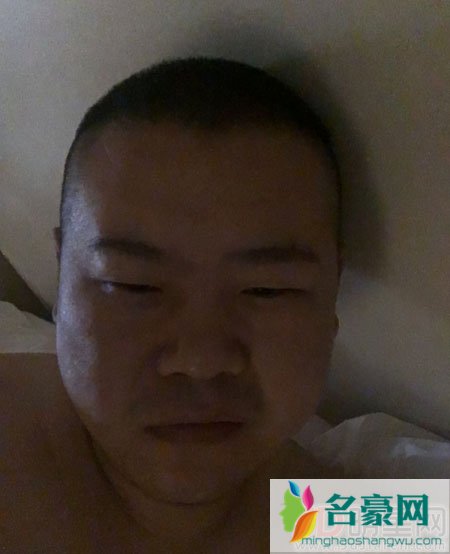 王祖蓝自曝整容前后照 盘点那些年学会PS的明星艺人