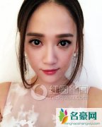 陈乔恩微博晒受伤照惹人疼 陈乔恩为什么受伤