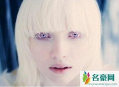世界上稀有的银眼睛人多数竟是白化病人，艾薇儿银
