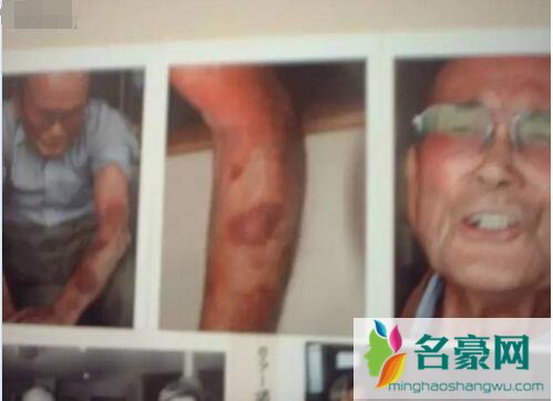 日本核辐射下的变异人