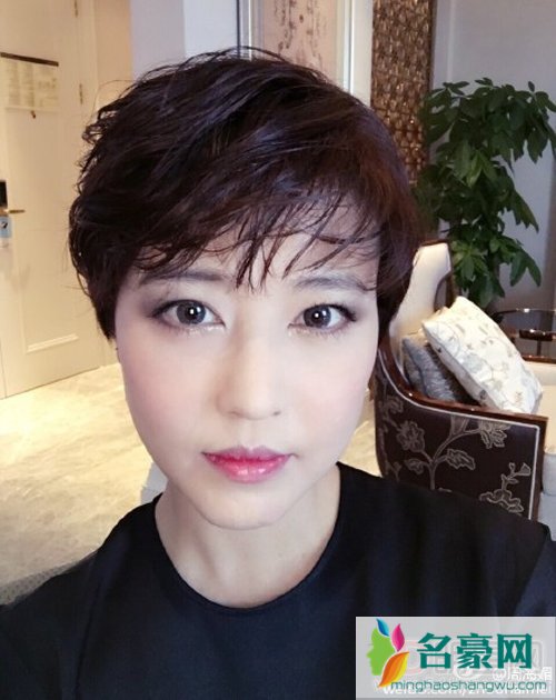 周海媚红斑狼疮近照 周海媚患过红斑狼疮