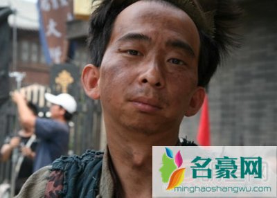 巨兴茂嘴怎么那样 巨兴茂去整容了没有
