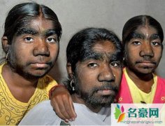 印度狼女卡玛拉，由狼抚养长大的女孩(喜欢吃生肉