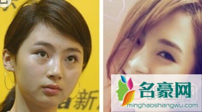 路晨有没有整容 路晨整容前后照片
