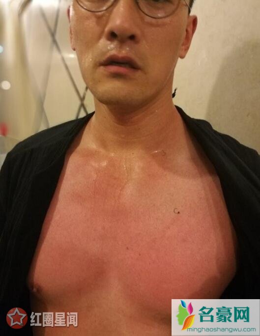 赫子铭现在怎么样了