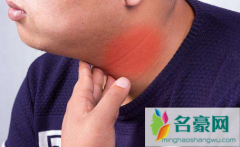 甲亢人的身上有一股味道吗 甲亢不到20天就好了正常