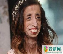 盘点世界上最丑的人，丑到极还有娇妻相伴/结婚5年