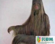 世界上体毛最长的人，艾米丽·苏珊脱毛后照片曝光