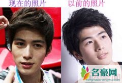 陈学冬整容前后照片变化惊人 揭秘陈学冬滚出娱乐