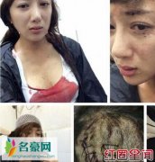 叶璇经纪人回应 宠物狗咬伤女星李依晓事件始末