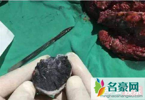 袁立否认私吞善款说了什么 袁立私吞善款是真的吗?