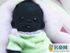 世界上最黑的孩子（全身没有一处是白的-黑出新高