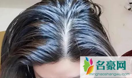 头发爱出油或是因为湿气重引起的吗2