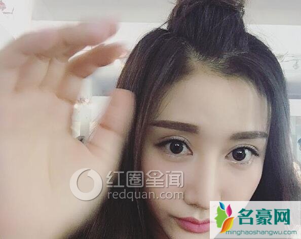 李林蔚整容前后对比