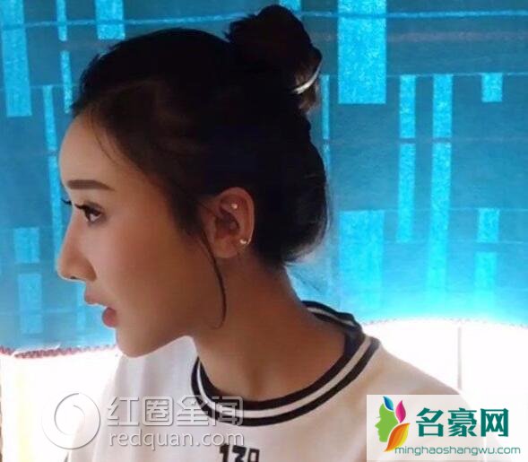 李林蔚整容前后对比
